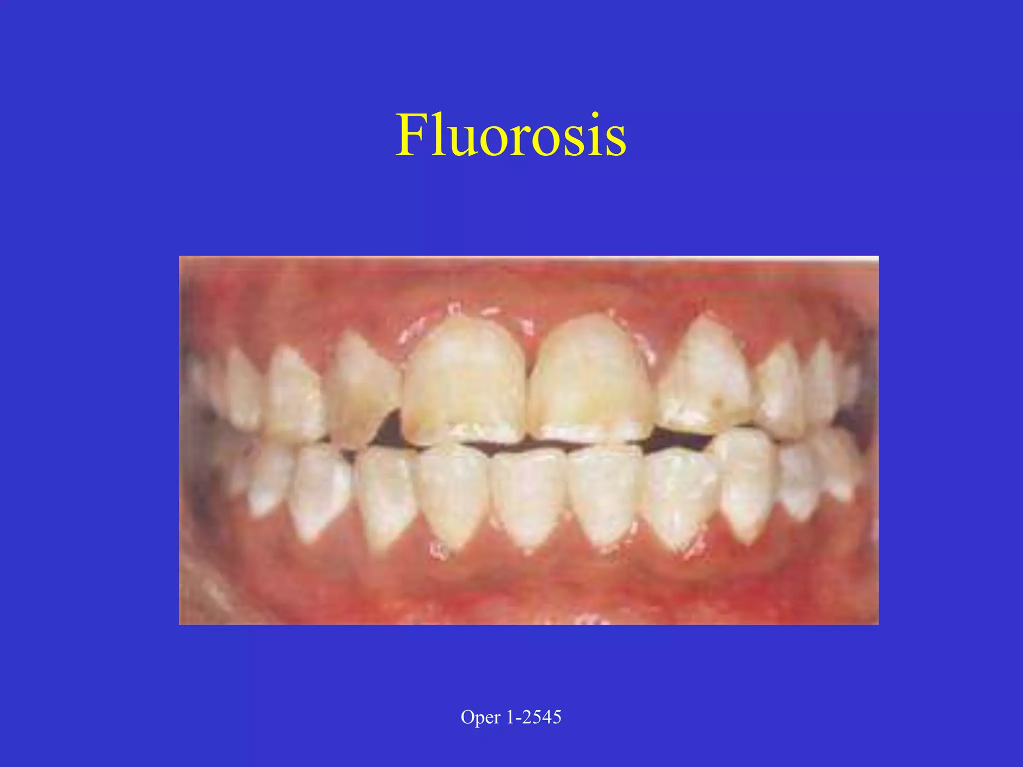 Clinical Diagnosis of Tooth Defects and Treatment Plan.ppt