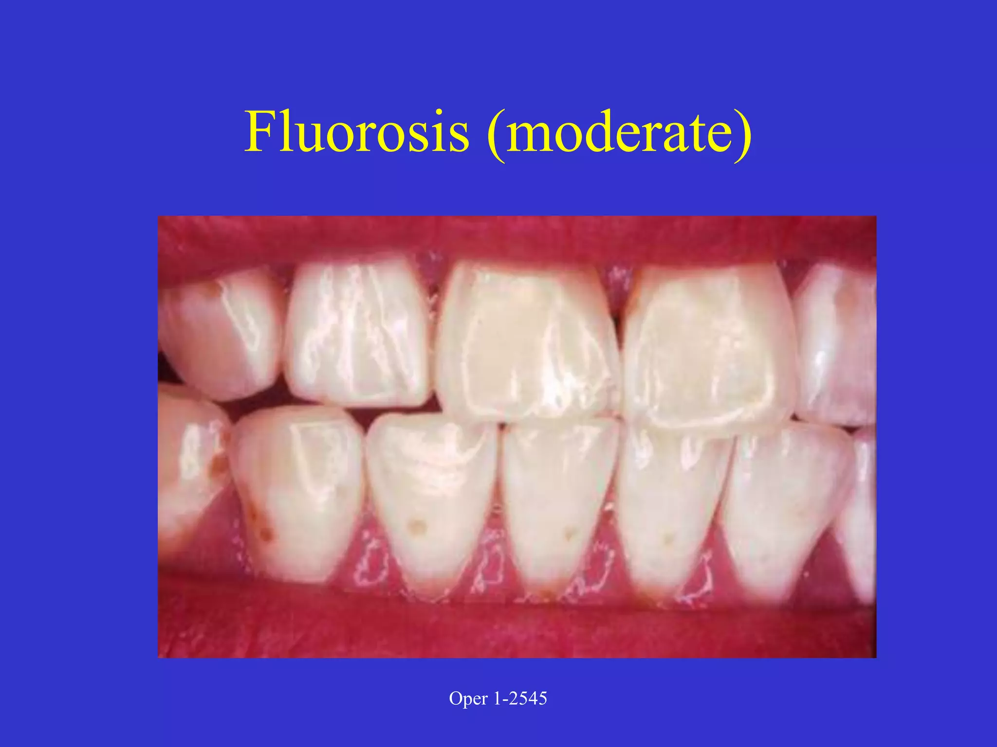 Clinical Diagnosis of Tooth Defects and Treatment Plan.ppt