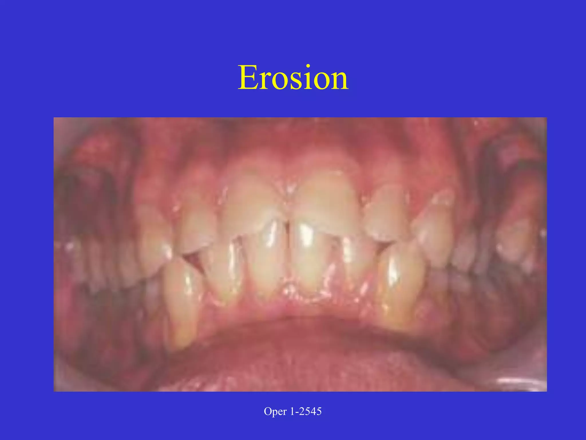 Clinical Diagnosis of Tooth Defects and Treatment Plan.ppt