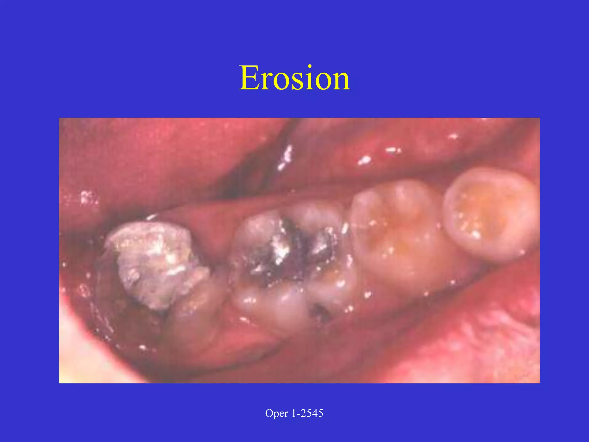Clinical Diagnosis of Tooth Defects and Treatment Plan.ppt
