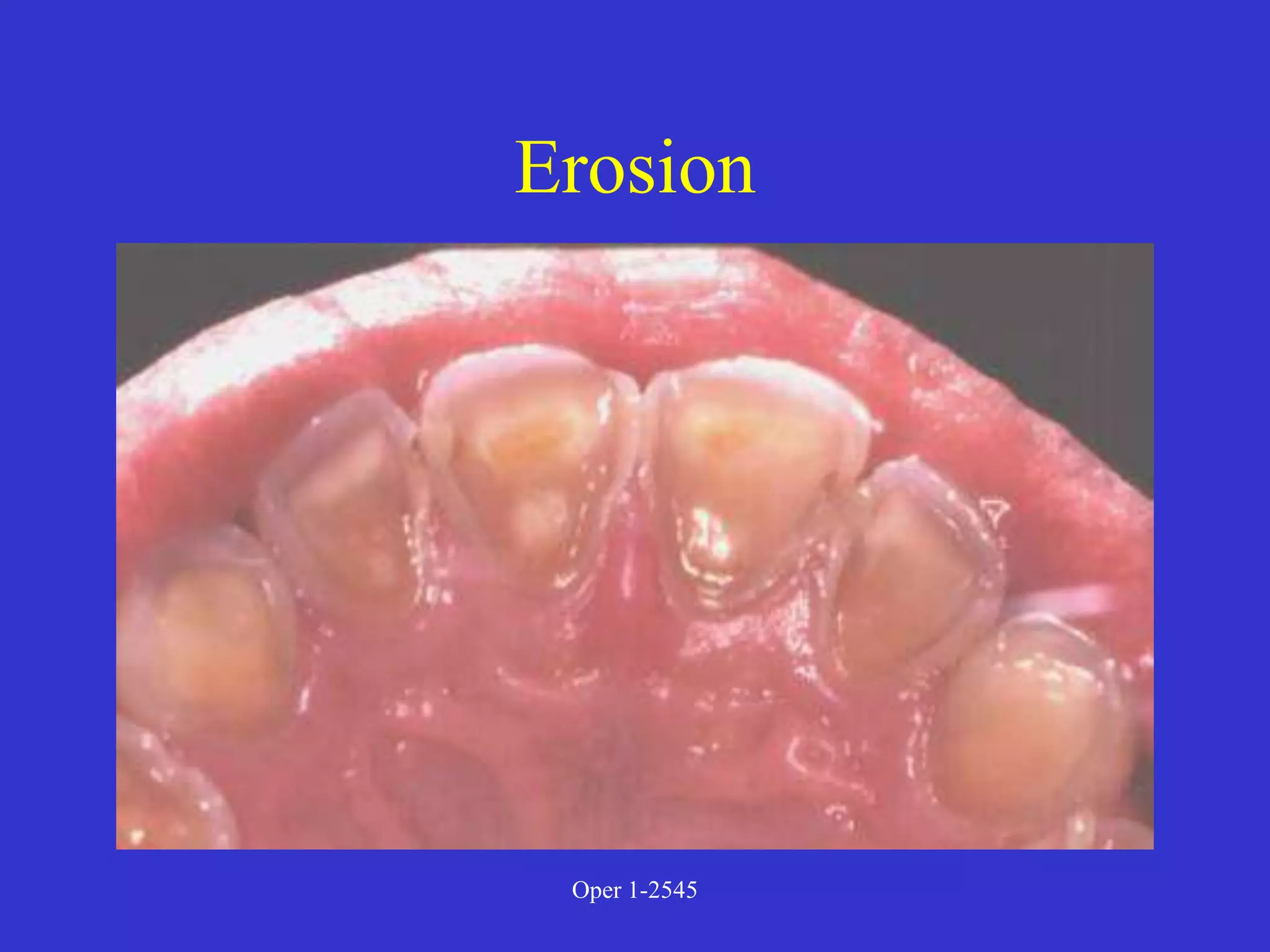 Clinical Diagnosis of Tooth Defects and Treatment Plan.ppt