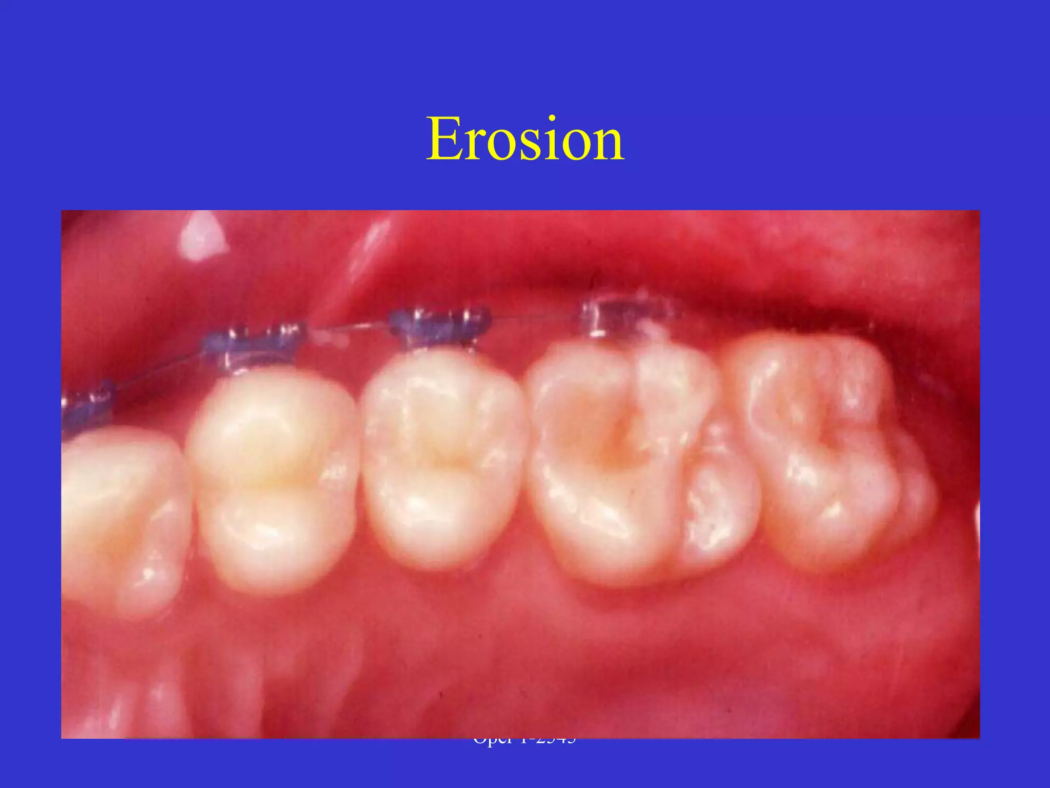 Clinical Diagnosis of Tooth Defects and Treatment Plan.ppt