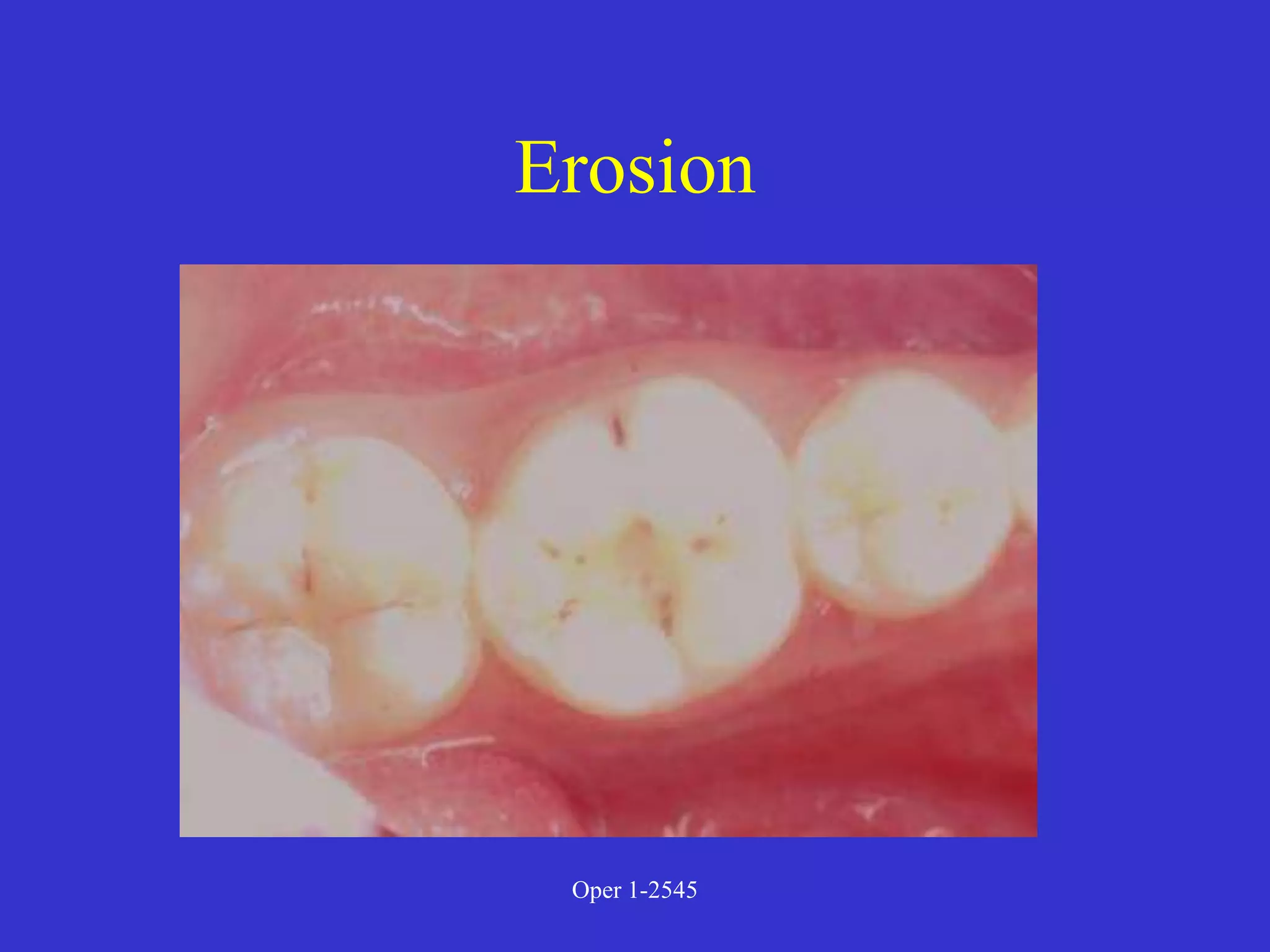 Clinical Diagnosis of Tooth Defects and Treatment Plan.ppt