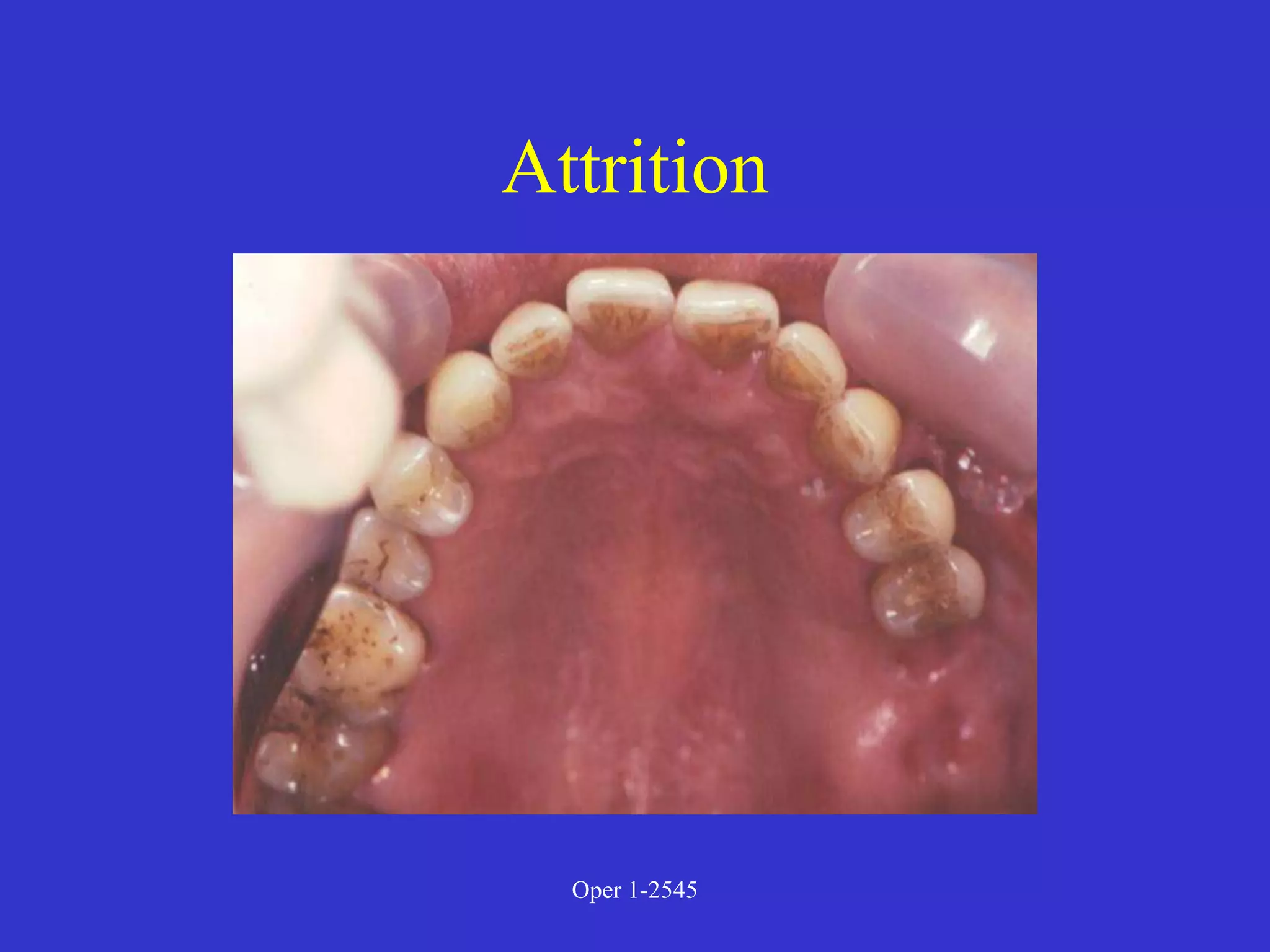 Clinical Diagnosis of Tooth Defects and Treatment Plan.ppt