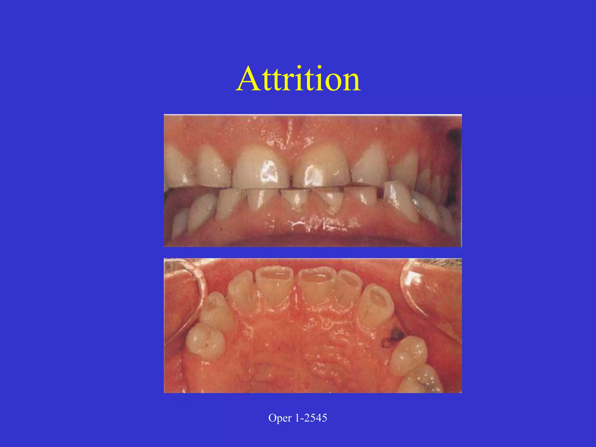 Clinical Diagnosis of Tooth Defects and Treatment Plan.ppt