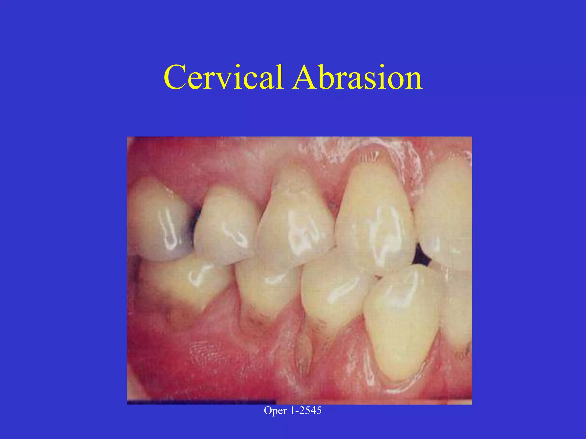 Clinical Diagnosis of Tooth Defects and Treatment Plan.ppt