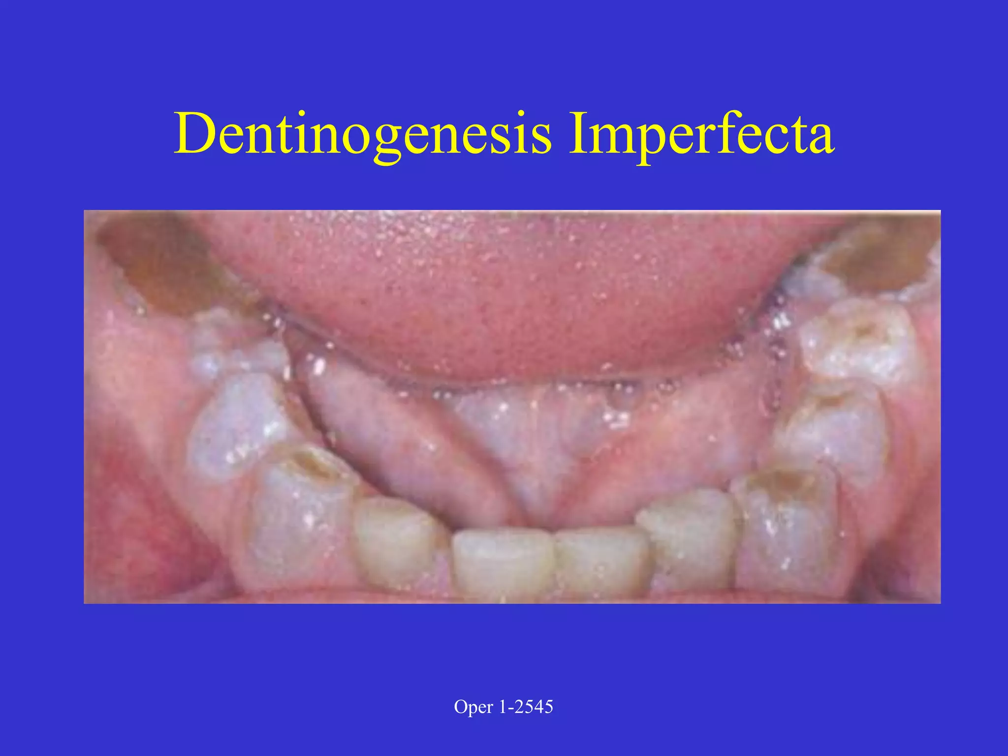 Clinical Diagnosis of Tooth Defects and Treatment Plan.ppt
