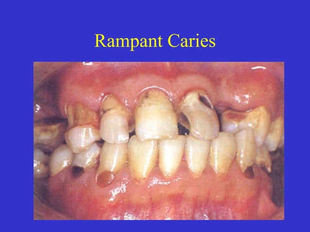 Clinical Diagnosis of Tooth Defects and Treatment Plan.ppt