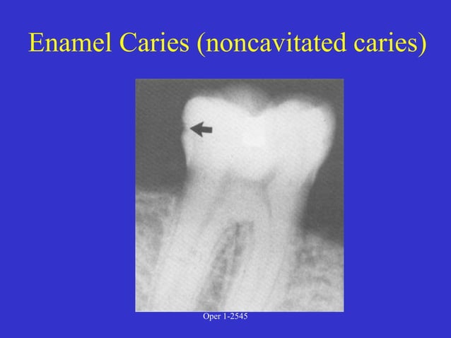 Clinical Diagnosis of Tooth Defects and Treatment Plan.ppt