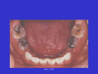 Clinical Diagnosis of Tooth Defects and Treatment Plan.ppt