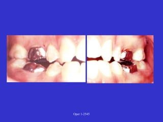 Clinical Diagnosis of Tooth Defects and Treatment Plan.ppt