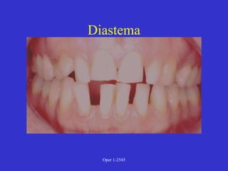 Clinical Diagnosis of Tooth Defects and Treatment Plan.ppt