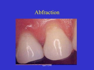 Clinical Diagnosis of Tooth Defects and Treatment Plan.ppt