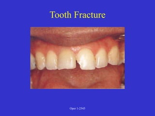Clinical Diagnosis of Tooth Defects and Treatment Plan.ppt