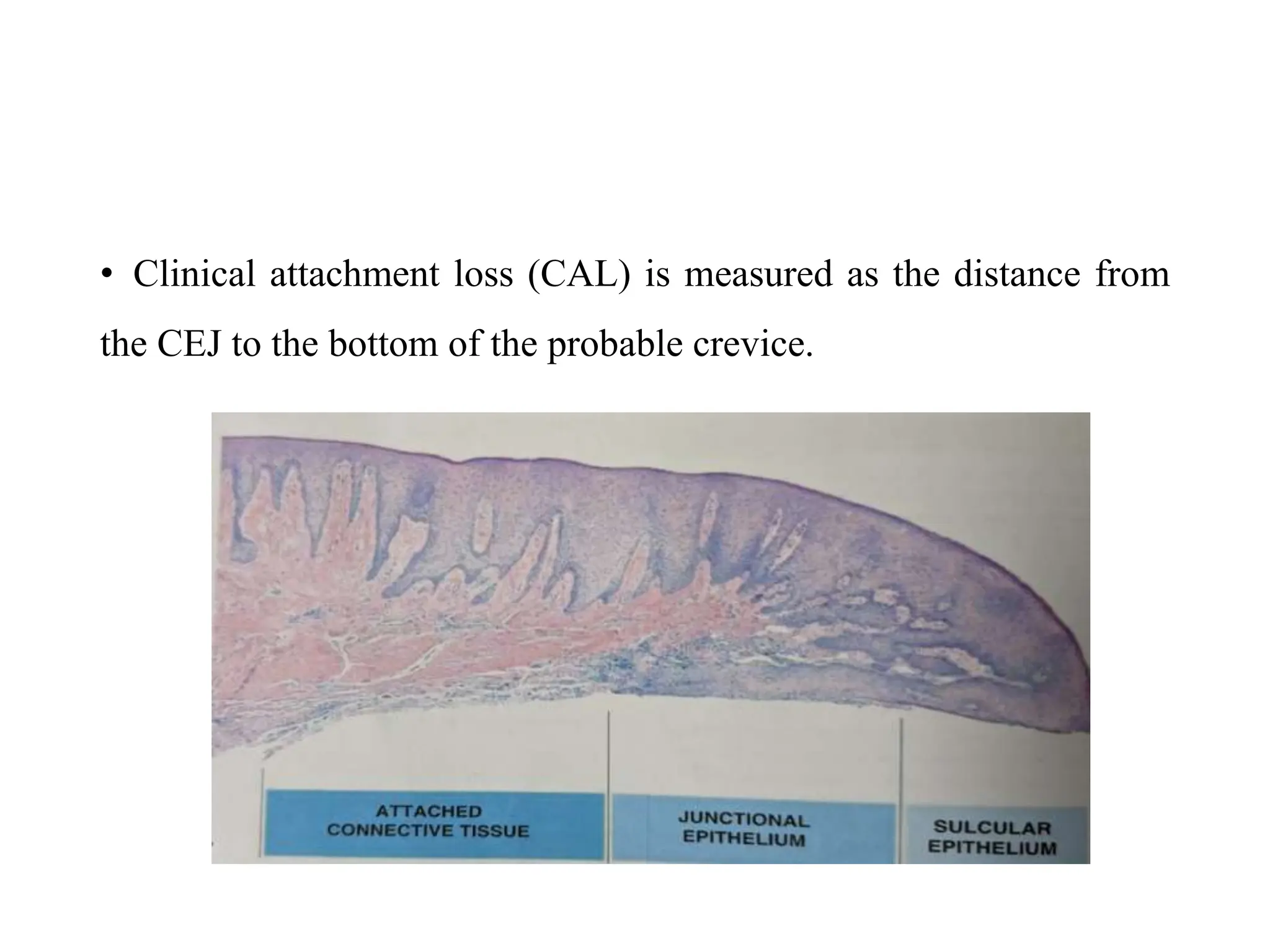 Clinical periodontology diagnosis part -2.pptx | Oral care | Personal Care