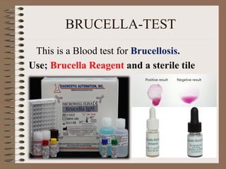 BRUCELLA-TEST
This is a Blood test for Brucellosis.
Use; Brucella Reagent and a sterile tile
 