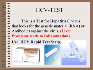 HCV-TEST
This is a Test for Hepatitis C virus
that looks for the genetic material (RNA) or
Antibodies against the virus. (Liver
Problems leads to Inflammation)
Use. HCV Rapid Test Strip.
 