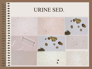 URINE SED.
 