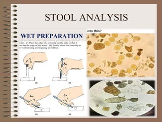 STOOL ANALYSIS
WET PREPARATION
 