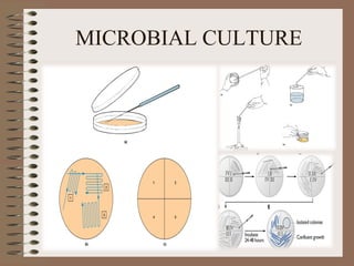 MICROBIAL CULTURE
 
