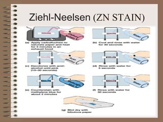 Ziehl-Neelsen (ZN STAIN)
 