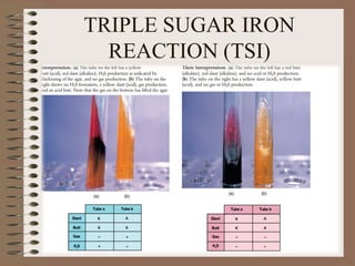 TRIPLE SUGAR IRON
REACTION (TSI)
 