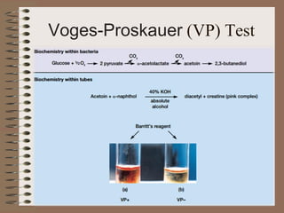 Voges-Proskauer (VP) Test
 