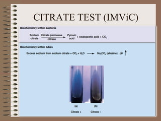 CITRATE TEST (IMViC)
 