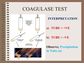 COAGULASE TEST
INTERPRETATION
a) TUBE = +VE
b) TUBE = -VE
Observe; Precipitation
in Tube (a)
 