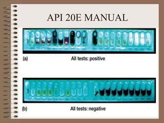 API 20E MANUAL
 