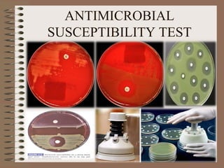 ANTIMICROBIAL
SUSCEPTIBILITY TEST
 