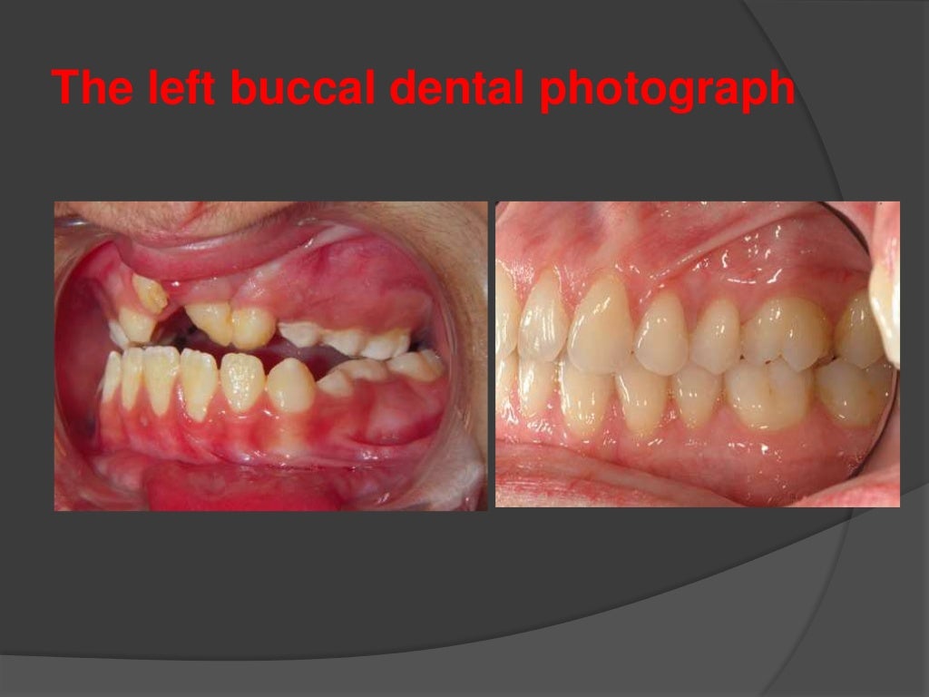 Clinical digital photography in orthodontics