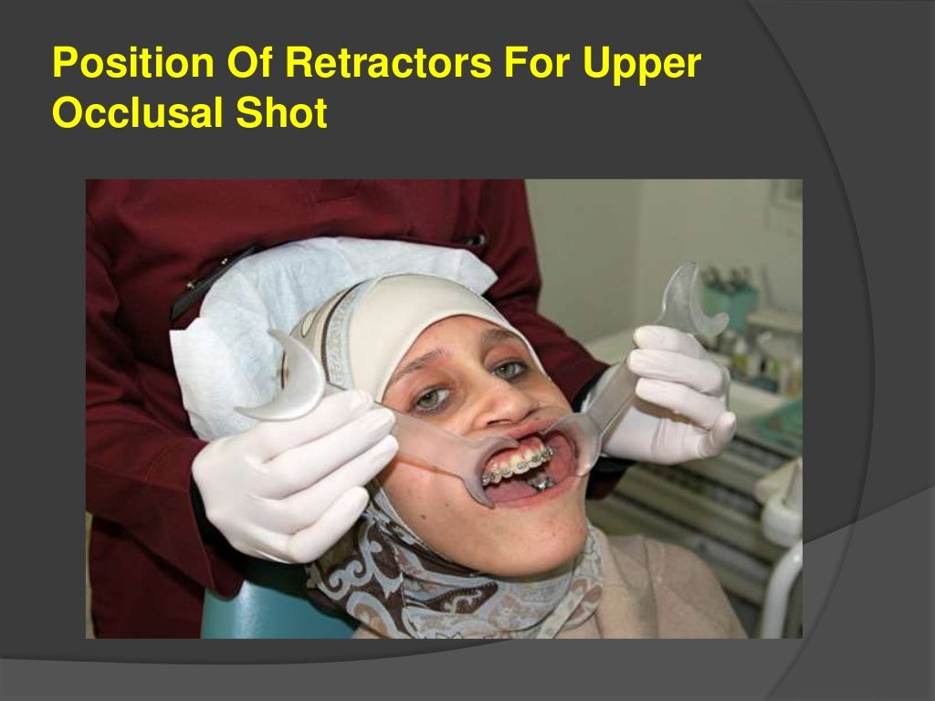 Clinical digital photography in orthodontics