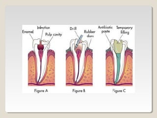 Clinical endodontics (treatment) | PPT