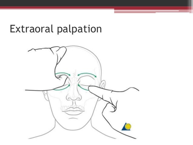 Laboratory abnormalities after a facial fracture school sex picture