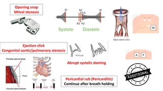 Opening snap
Mitral stenosis
Ejection click
Congenital aortic/pulmonary stenosis
Abrupt systolic doming
P
A
M
Pericardial rub (Pericarditis)
Continue after breath holding
 