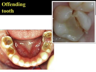 Clinical examination