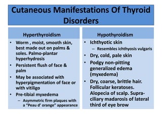 Hyperthyroid Skin Clinical examination of Endocrine system | PPTX