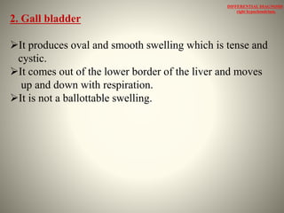 Clinical examination of abdominal lump | PPTX