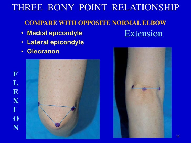 Clinical examination of elbow joint