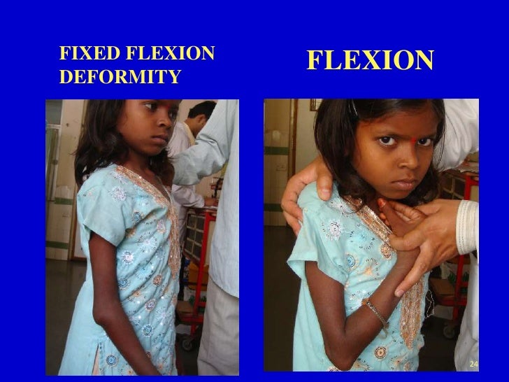 Clinical examination of elbow joint