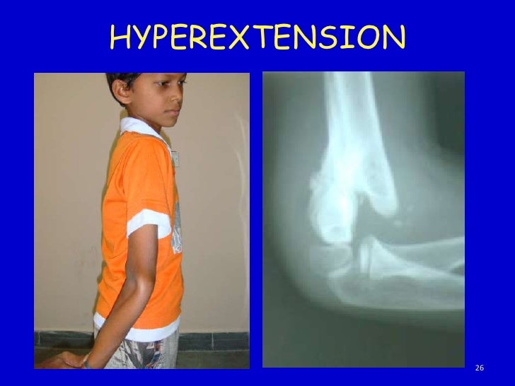Clinical examination of elbow joint