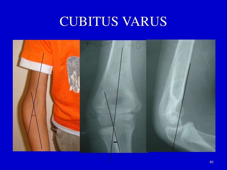 Clinical examination of elbow joint
