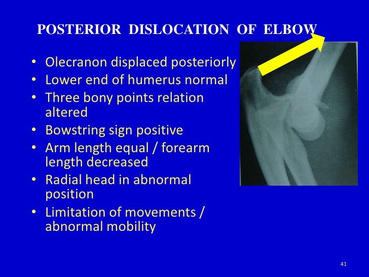 Clinical examination of elbow joint