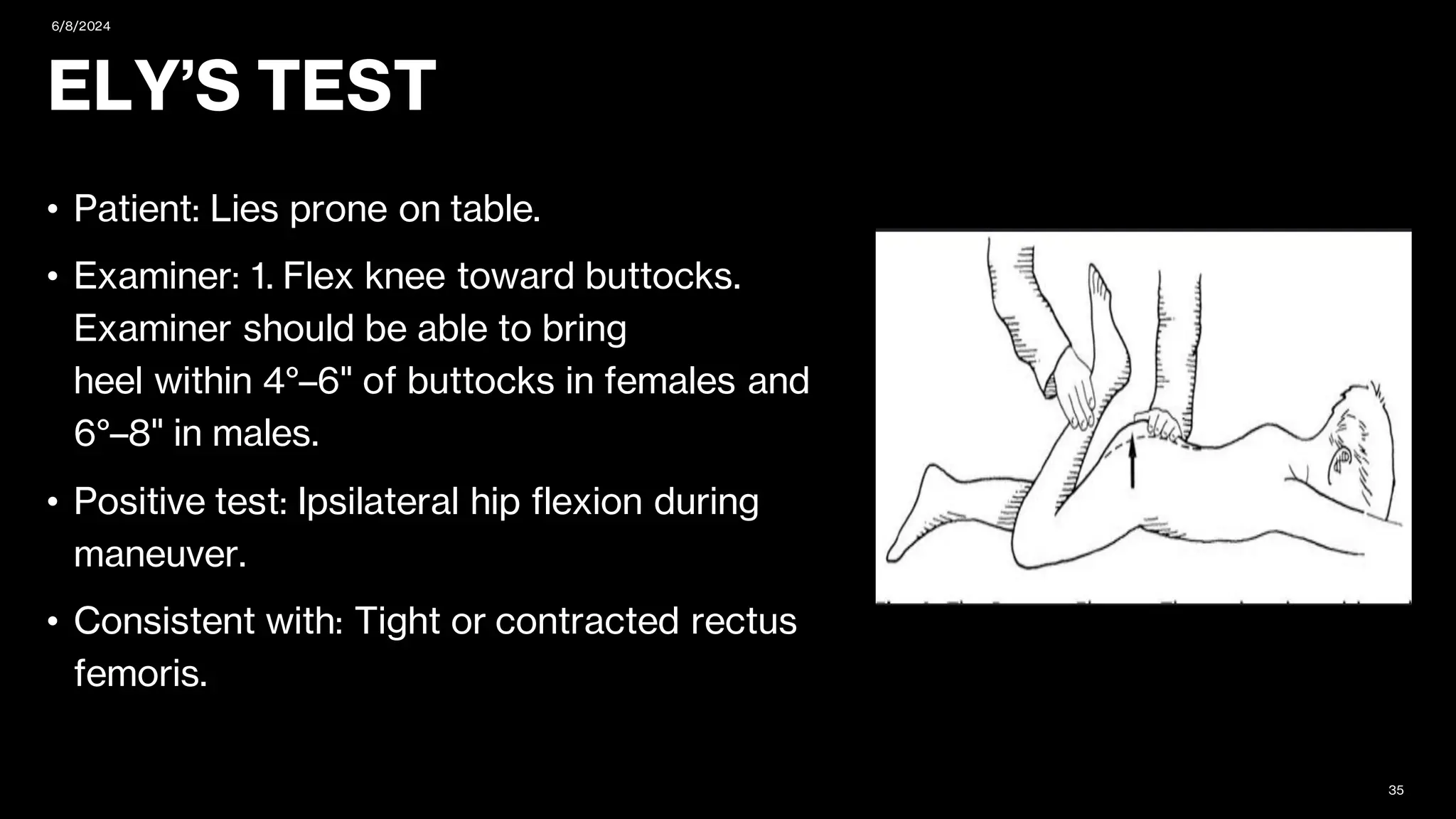 clinical examination of hip joint (1).pdf
