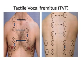Friction Fremitus clinicalexaminationofrs-190222051629.pptx