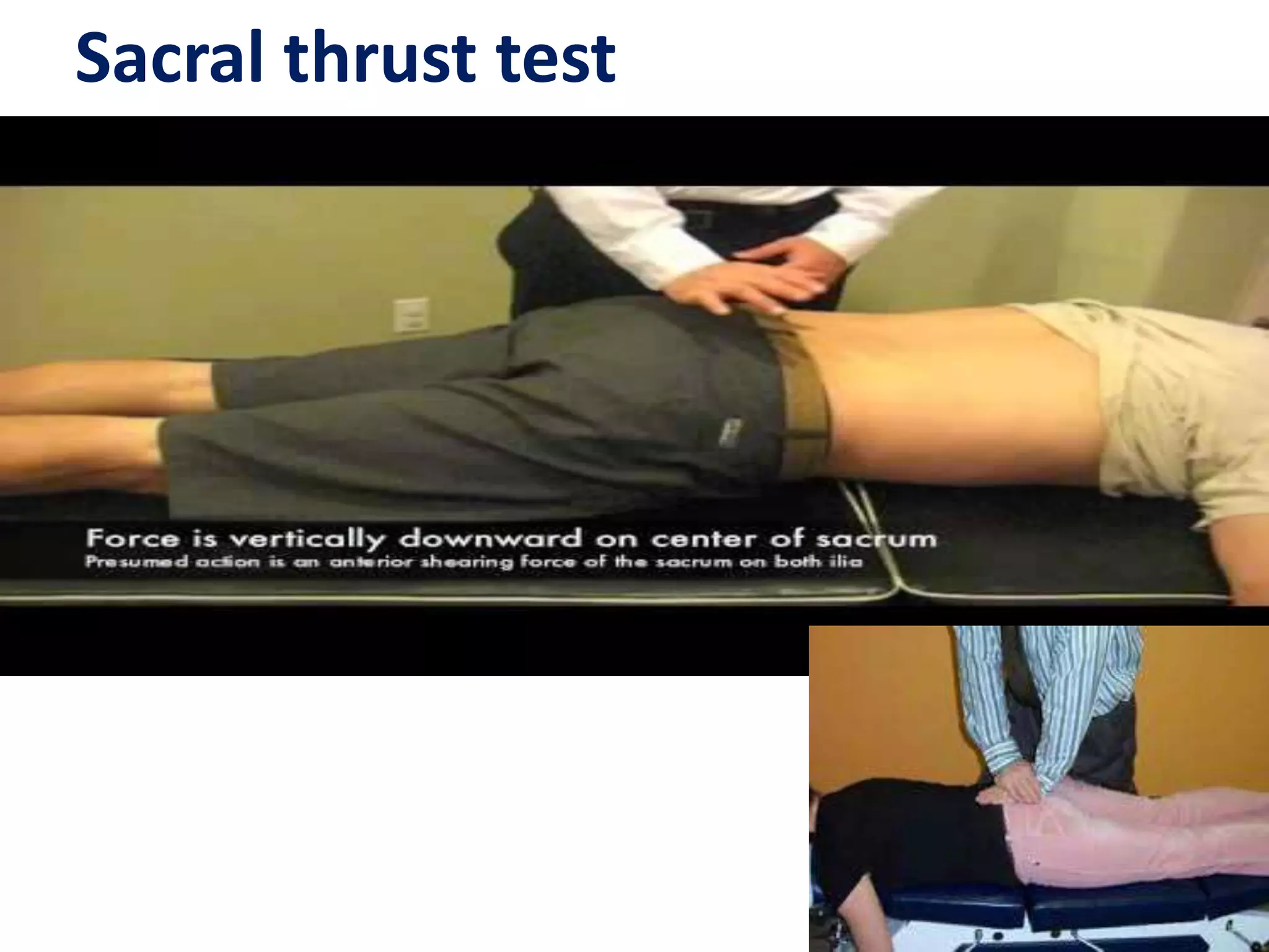 Sacral Rotation Test Clinical examination of spine | PPT