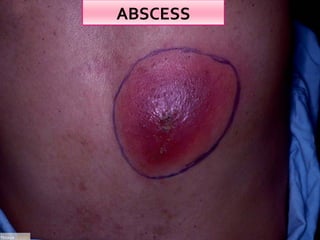 Clinical examination of swelling | PPT