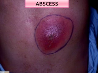 Clinical examination of swelling | PPTX
