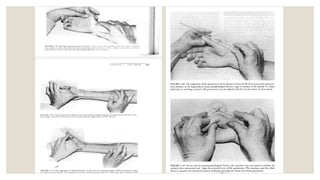 Hand Examination Example CLINICAL EXAMINATION OF THE HAND & WRIST JOINT. SLIDESHARE.pptx